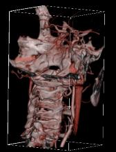 volume) Soft tissue imaging Enhanced visualization of tendons &