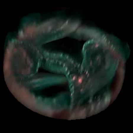 That s a very powerful feature of light field microscopy with providing 3D shape information for a specimen from a single photo.