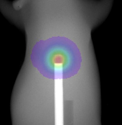 effect X-ray penetration Light appears on the tissue surface be means of the shortest path, X-rays penetrate