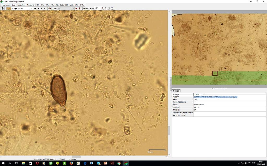 Not available for manual microscopy completeness and speed of Visual analysis using MECO-PARAS digital 3D VS.