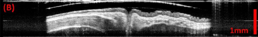 (d) Cross-sectional images along the pull back direction in the esophagus. Scale bar: 1mm. Figure 4.