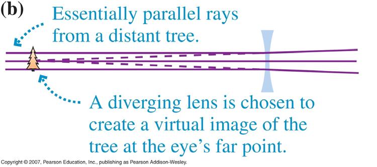 Correction of Nearsightedness To correct nearsightedness, lights rays from a distant object must be made to