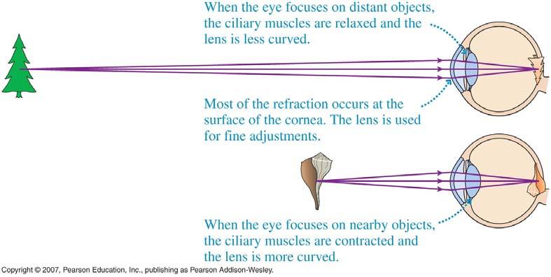 The Human Eye The cornea, aqueous humor, and the lens refract the incoming light to produce a sharp real image on the retina.