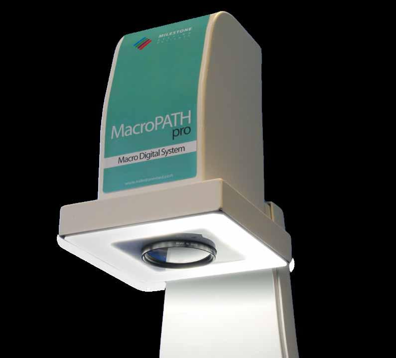 MILESTONE H E L P I N G P A T I E N T S MacroPATH The new line of Digital Imaging Systems for