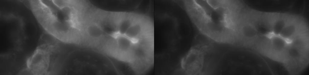 Bleaching Bleaching before and after 100x imaging same area with