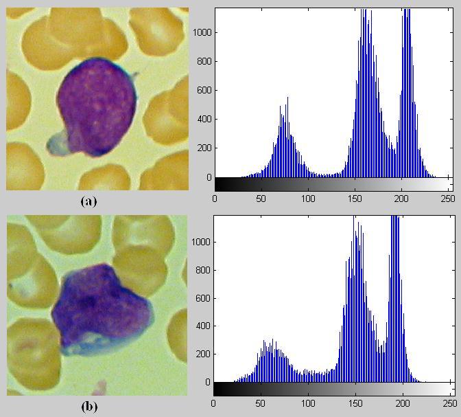 Journal of Biomedical Engineering and Medical Imaging, Volume 2, No 2, April (2015), pp 26-34 Figure 6: Original RGB images For segmentation framework based RGB color space, the results of applying