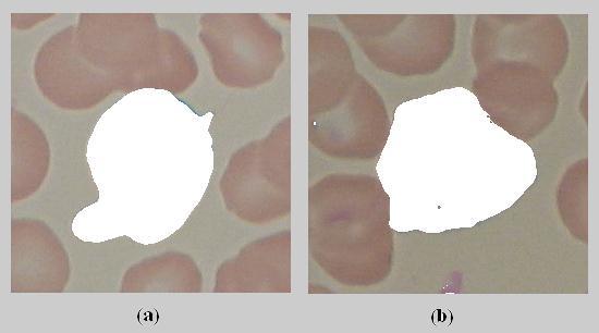 Journal of Biomedical Engineering and Medical Imaging, Volume 2, No 2, April (2015), pp 26-34 Figure 12: Segmented images using HSV Figure 13: Ghost images for HSV segmentation Therefore, Figure 12