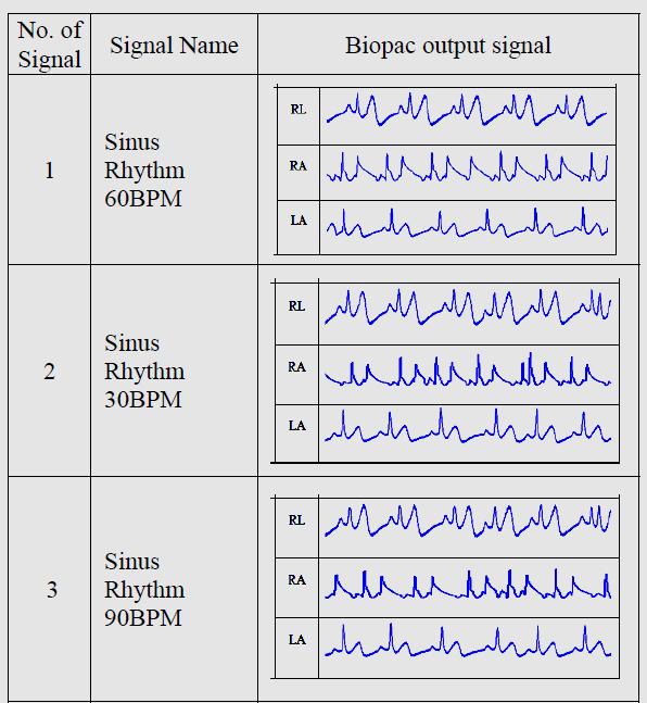 Figure : s from BIOPAC. IV. CONCLUSIONS In this research, a -lead ECG Simulator has been designed and developed. Signals were recorded, which were then analyzed further.