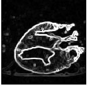 Examples: Medicine Processing (2002) Take slice from MRI scan of canine