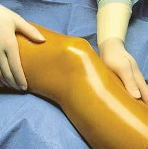 most arduous procedures and manupluation. They are soft and pliable for easy application.