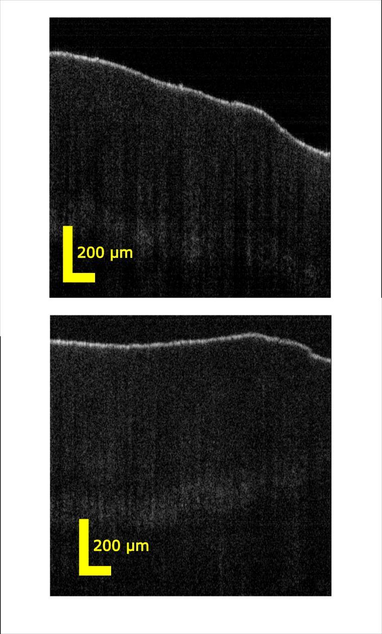 a) b) Fig. 4: OCT B-scans of human nail taken in-vivo from a volunteer s finger. (a) Super K Extreme R = 320 MHz. (b) Supercontinuum R = 20 MHz. 4. CONCLUSION In conclusion, we have investigated the effect of the laser seed pulse repetition rate on the noise of a SC for UHR- OCT at 1300 nm.