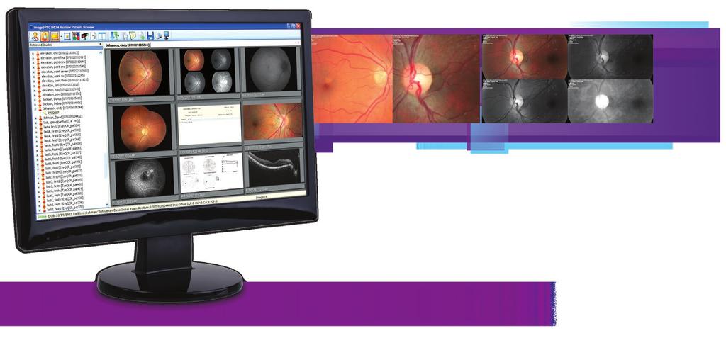 FITS EASILY INTO NEARLY ANY BUSINESS ENVIRONMENT Being DICOM-compliant allows imagespectrum to be quickly and easily integrated into a wide range