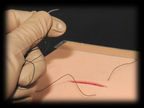 suture material.