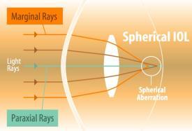 The Problem Spherical Optics The Solution- Aspheric Optics Aspheric IOL Spherical aberration occurs when marginal rays are overrefracted, resulting in a