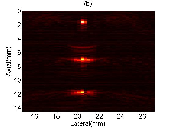 0 2 (a) 0 2 F (b) 4 4 E 6 E 6 ` 8 ` 8 10 10 12 12 14 16 18 20 22 24 Lateral(mm) 26 14 16 18 20 22 24 Lateral(mm) 26 Figure 3: Photoacoustic images of a phantom with three point targets: images