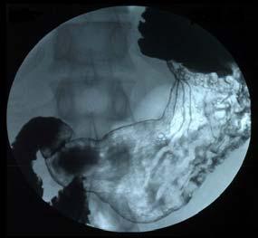 Anatomical X-ray