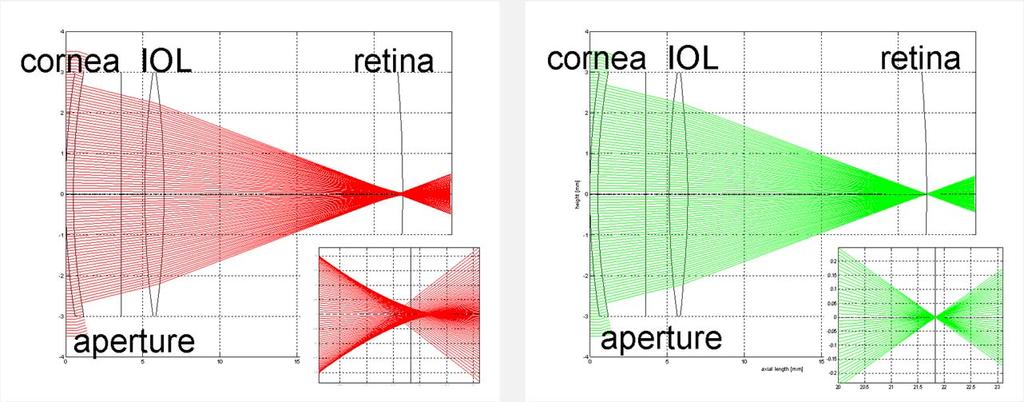 First step in individual IOL: Correction of SA The cornea shows in general a positive spherical aberration SA A spherical IOL implanted in the eye adds some SA to the system An aspherical