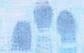 Interpretation Instructions Results Expected Fingerprints similar to those shown in the photographs to the right should be visible. Possible Reasons for Poor or No Results Insufficient treatment time.