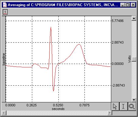 Comparing Multiple Waveforms While this averaged ECG signal by itself gives you an excellent diagnostic tool, the ability to compare other scenarios will be an even more valuable tool.
