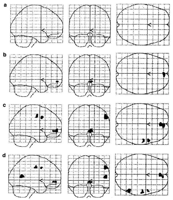 Simulation Theory Neural Mechanisms of Mindreading TOM+SELF- TOM-SELF- TOM+SELF+ TOM-SELF+ Evidence of overlapping brain regions involved in SELF and TOM SELF: meta-representational cognitive