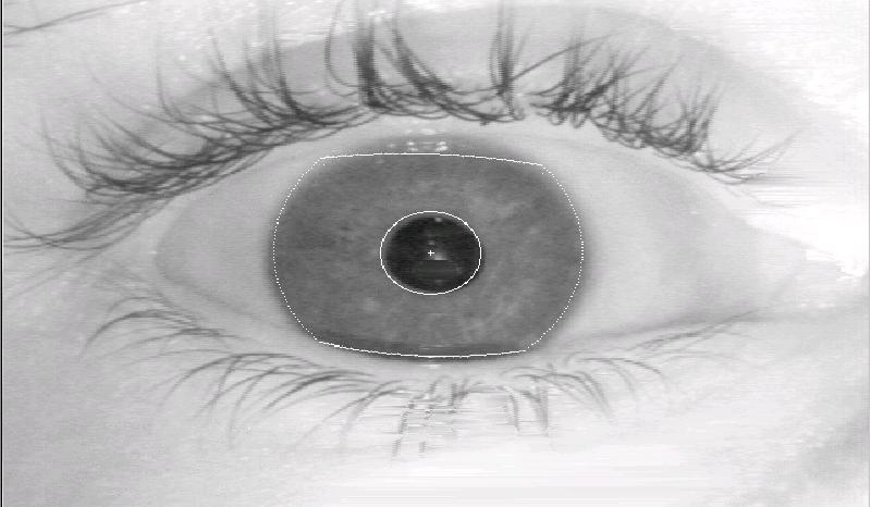 Why Iris Recognition Technology?