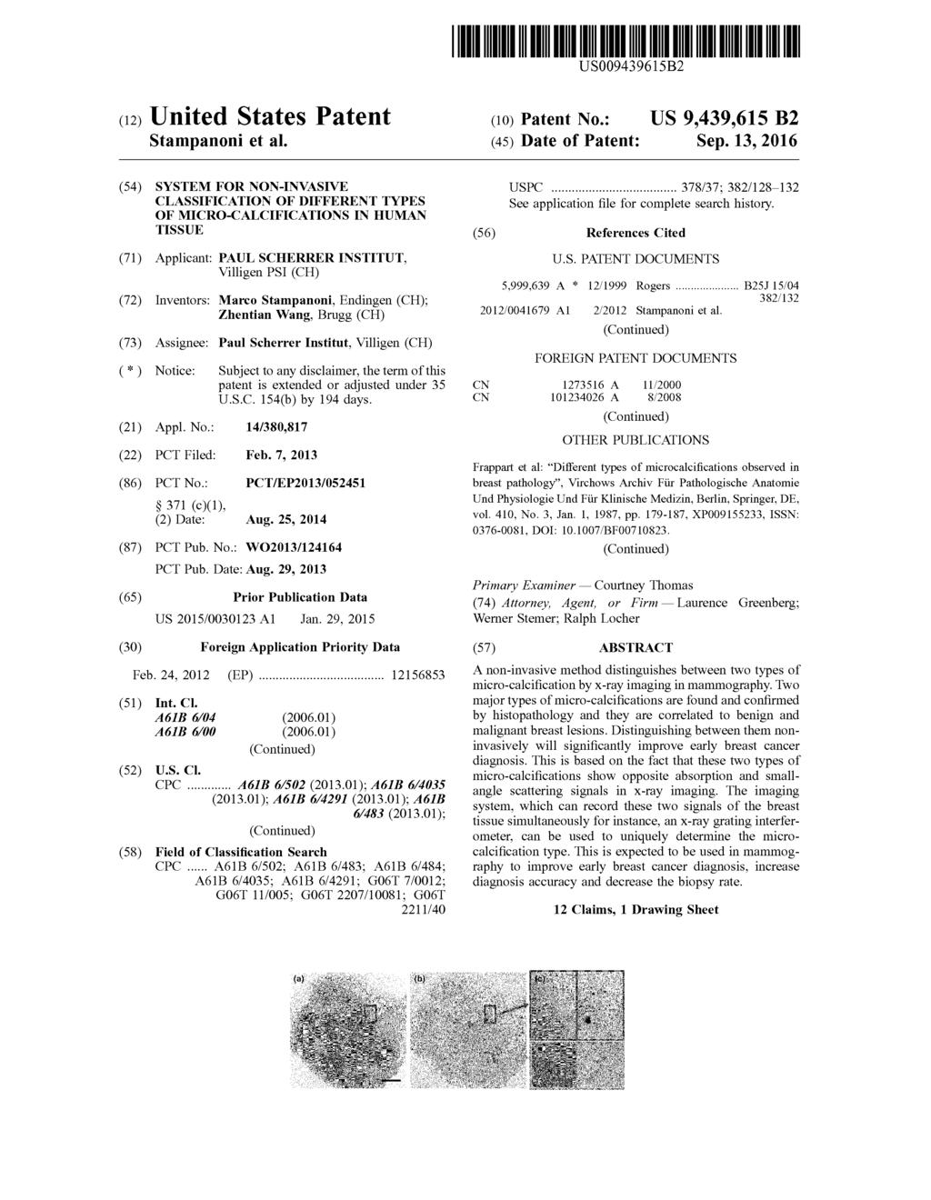 USOO94396B2 (12) United States Patent Stampanoni et al. () Patent No.: () Date of Patent: Sep.