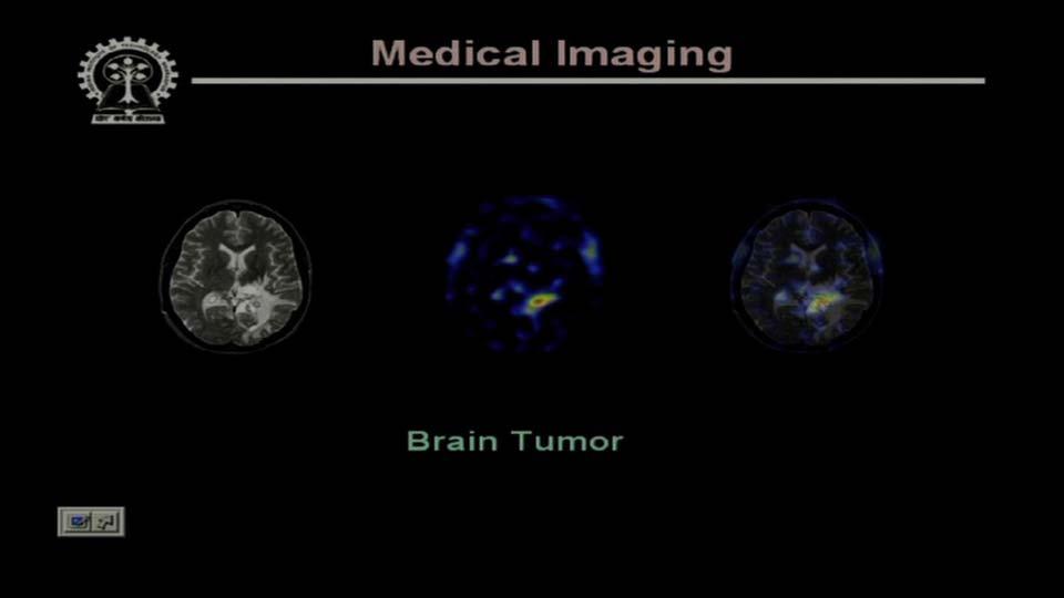 (Refer Slide Time 08:28) Now other major application of digital image processing techniques is in the area of medicine.