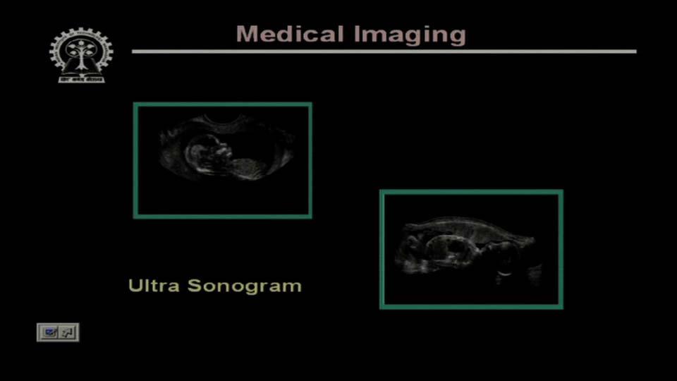 This is another application of the image processing techniques in the medical field where you have shown some images, some mammogram images which shows the presence of cancerous