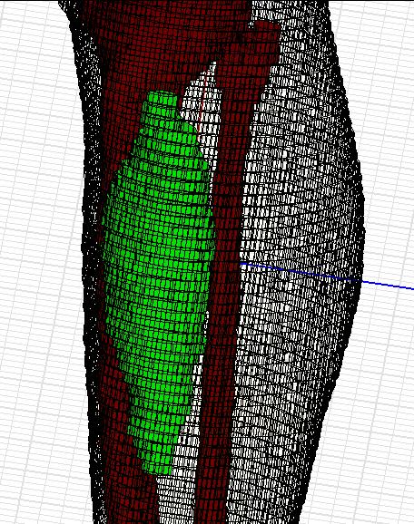 Simulations in Realistic Models: Patient Body Model Patient body model can be made by utilizing computed tomography (CT) or other medical imaging methods.