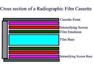 Image recording Photographic emulsion is not sensitive for X-photons but is for visible light - only 1% of incident X-photons are absorbed in film It would require a long irradiation of patient to