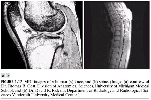 Examples: MRI
