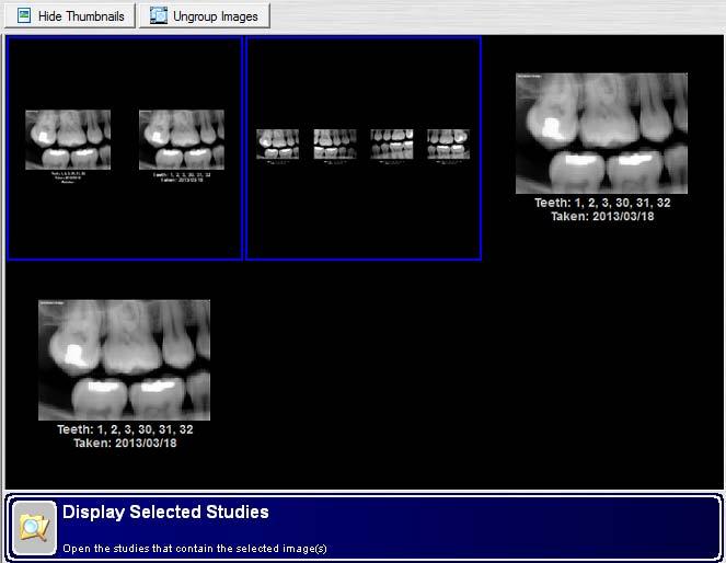 Selecting Thumbnails for Viewing 1. Open XrayVision DCV. 2. Select View Images. 3. Perform an image query. 4.