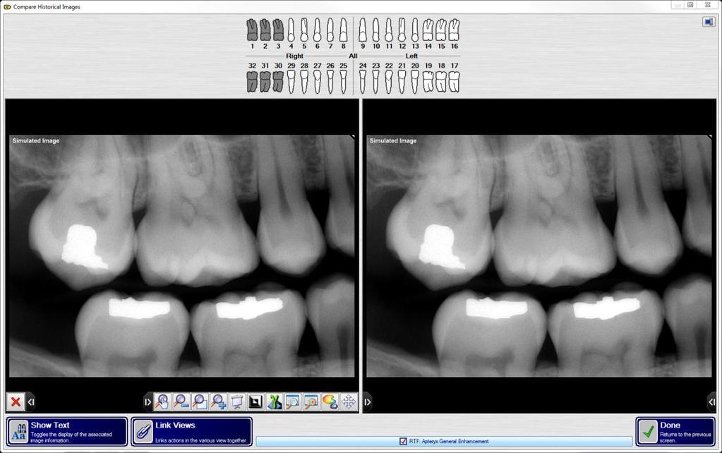 8. All images associated with the selected teeth are displayed. 9. Using the pop-out toolbars in the lower corners of each image tile.