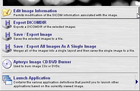 Save/Export Image: Save/Export Image allows an image to be saved outside of our software as a non-dicom image. CD/DVD Burner: This function allows all selected images to be burned to a disk.