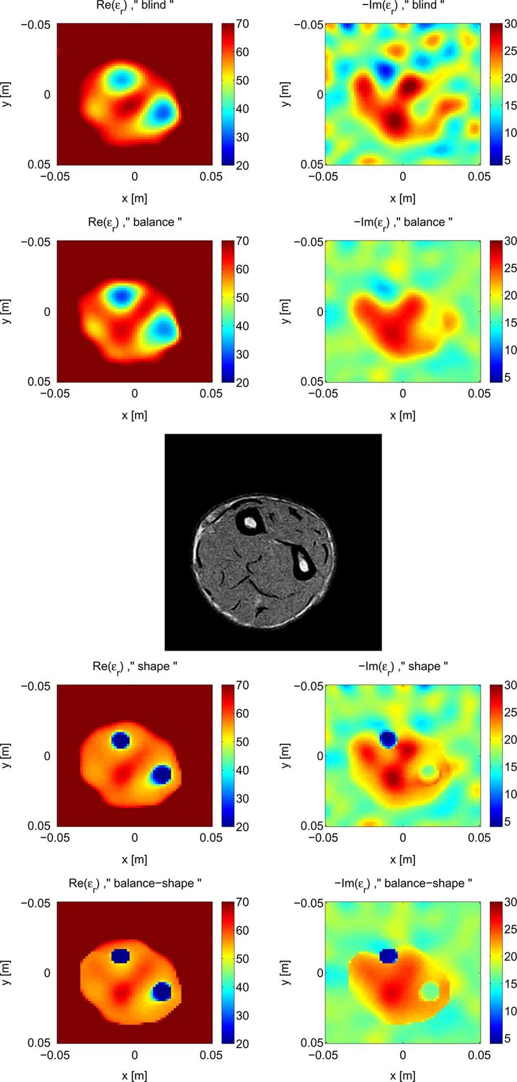 OSTADRAHIMI et al.: ENHANCEMENT OF GNI METHOD FOR BIOLOGICAL TISSUE IMAGING 3431 Fig. 7. Images of (left)and (right) of the bovine leg, matching fluid: salt_12.5, frequency of 1.2 GHz.