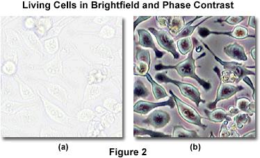Benefit of Phase Contrast (Question 21) Human glial brain tissue cells Major Advantage: Ability to view