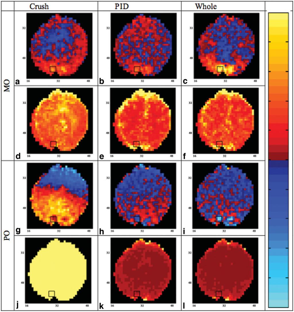 Complex-Valued Analysis of ASL Functional MRI Signals 1603 FIG. 5. Maps of the parameter and variance estimates for the magnitude-only and phase-only models.