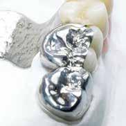 Thus, Dentaurum ensures that only DIN Standard rematitan M titanium of proper purity