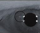 The built in Scanning Laser Ophthalmoscope (SLO) allows for high quality retinal observations and precise