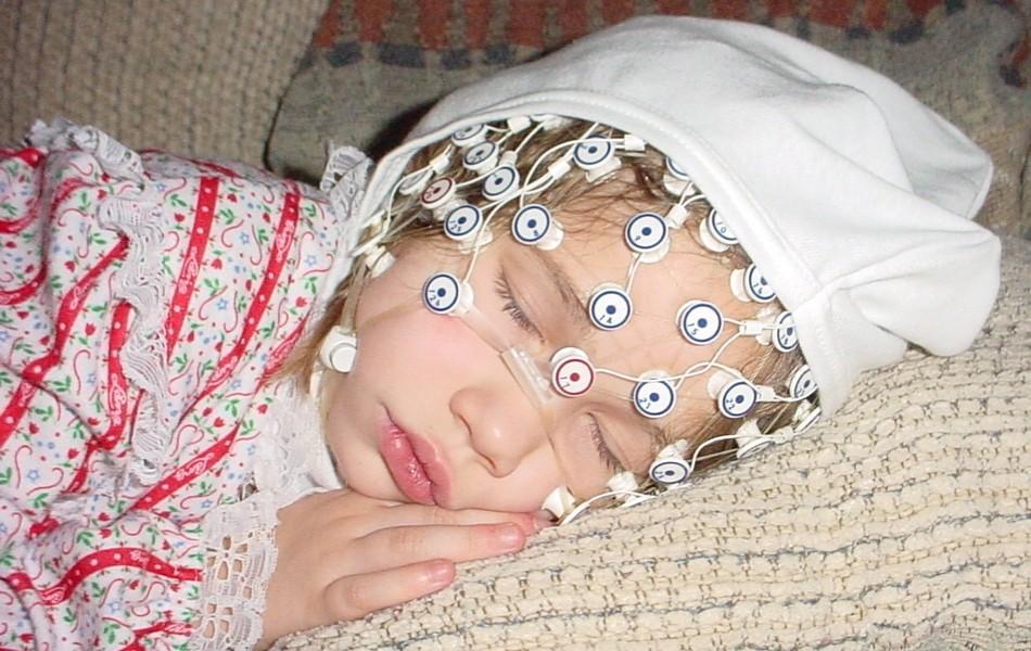 EEG caps Facilitate application of a large number