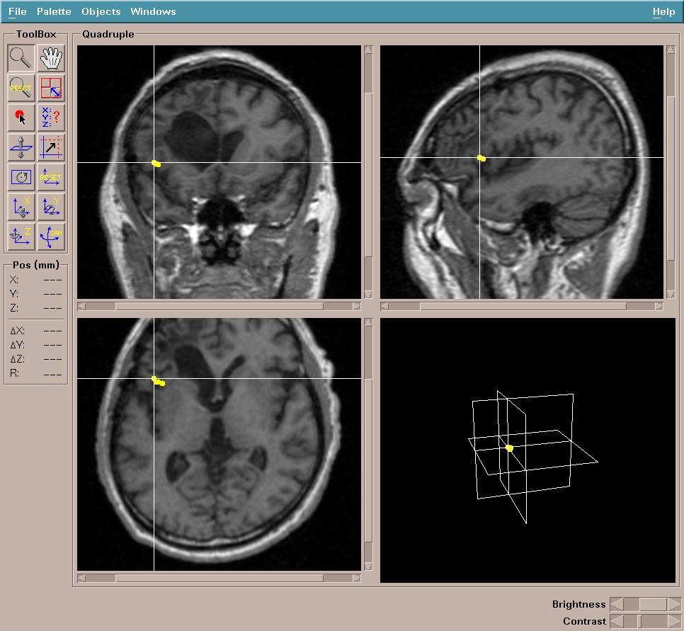 MEG/MRI integration Coordinate systems MRI device