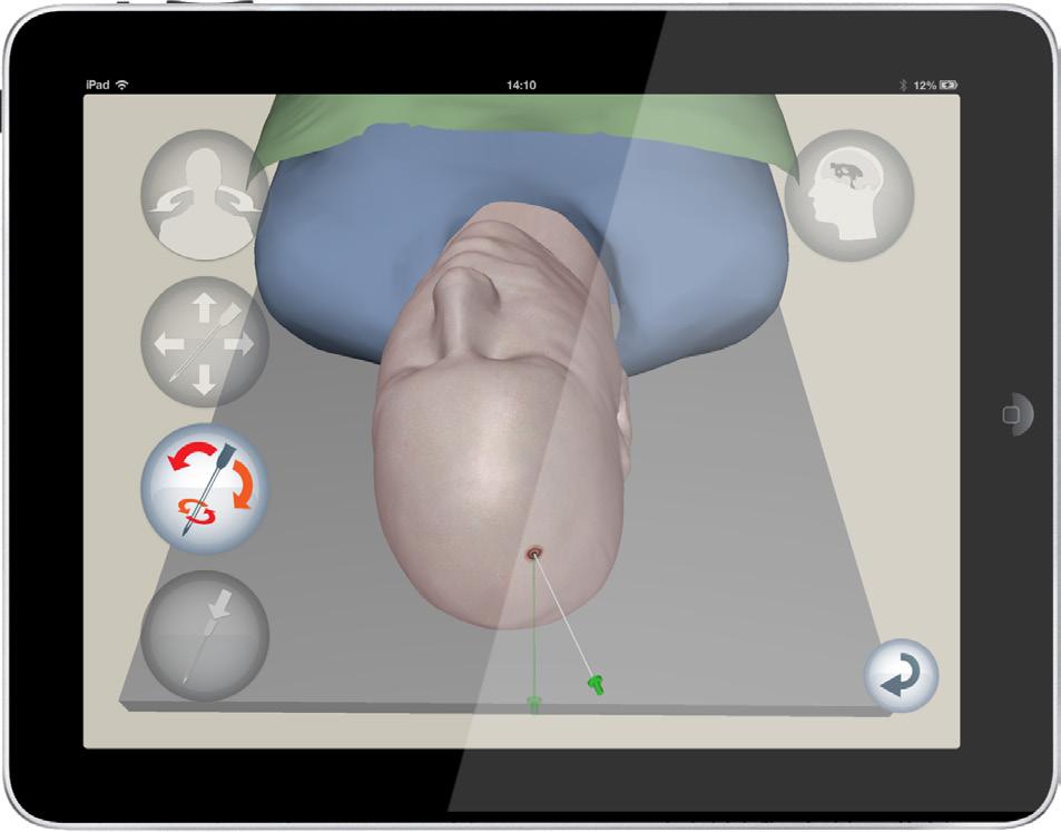 Education and Training Demo: VCath: A Tablet-based Neurosurgery Training Tool Aimed at: Neurosurgery, but many other procedures could be modelled VCath has been developed as an ipad App to take a