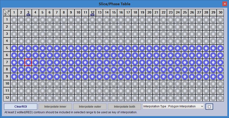 Aquarius intuition Client Chapter 6 Figure 6-7: Slice/Phase Matrix Each row represents a slice that lies within the range you selected using the Start and End buttons.
