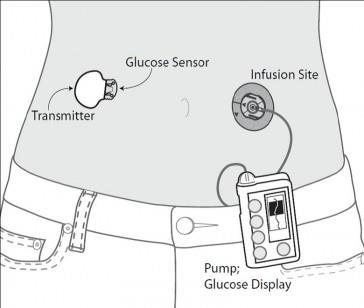 Real Time Glucose