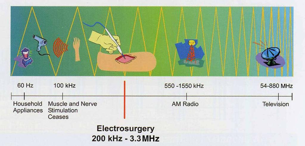 Electrosurgical units are radio frequency (RF) generators: Typically 450-500 khz, but