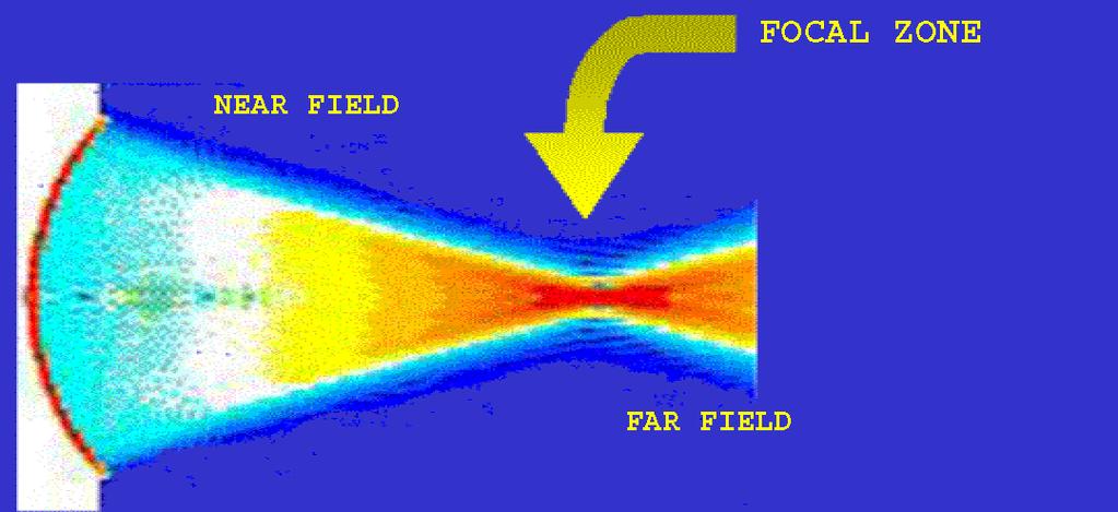 Focus and Resolution Focused beam width determines Lateral and Azimuthal Resolution Near field (Fresnel Zone) Large variations of intensity Far field (Fraunhofer Zone) Greater variation with greater