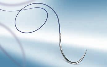 MONOFILAMENT ADVANTAGE The main advantages of using monofilament sutures: The monofilament sutures appear to have the lowest infection promoting effects (, 2).
