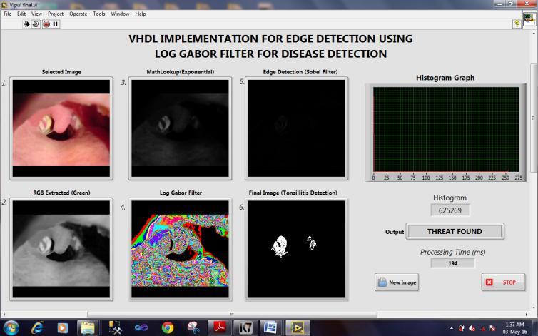 Fig 10(c) Disease detection with sobel operator Fig 9 (d ). Code deployment process VII.