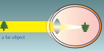 The image formed by a concave lens is always: virtual, small & erect.