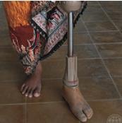 The Jaipur Foot Device The Jaipur foot is a lower-limb replacement device.
